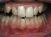 crown1.jpg