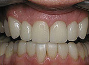 crown2.jpg
