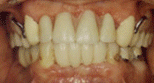 implants1.jpg