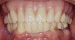 implants2.jpg